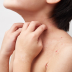 こどもかきむしる